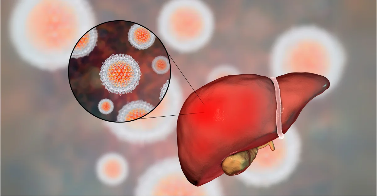 How to select the right oncology model